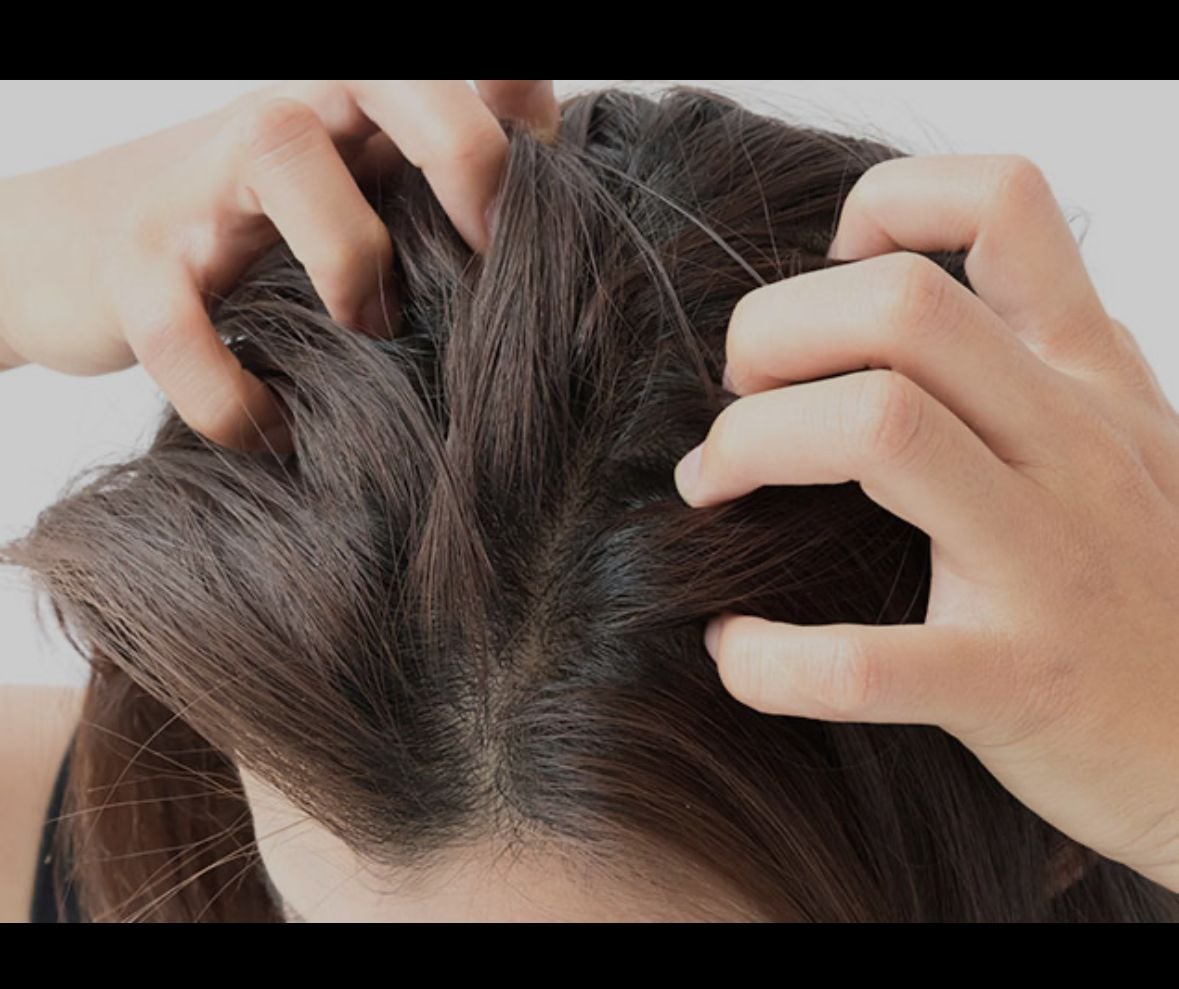 Anti prurito e dermatite — trattamento capelli a Victoria's Hair Spa Ferrara